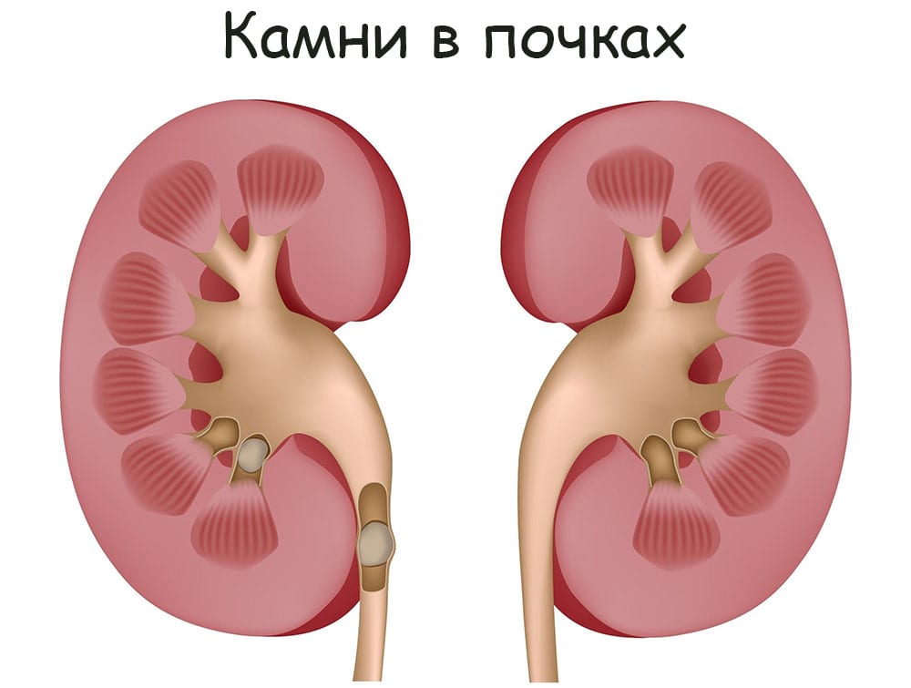 Кракен сайт наркотиков